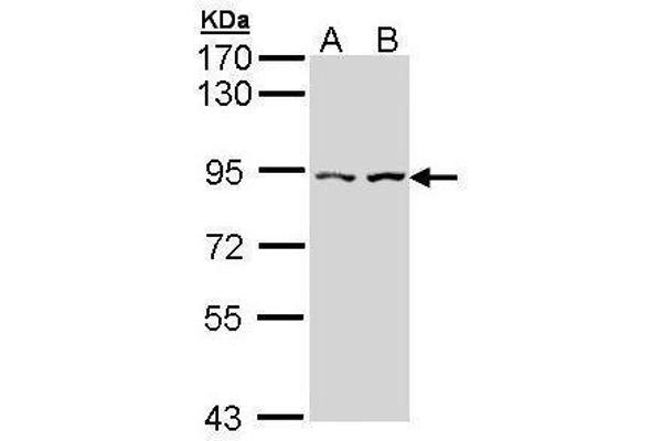 CTNNAL1 抗体  (Internal Region)