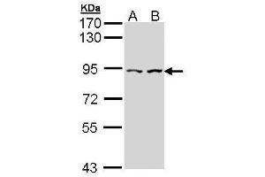WB Image Sample (30 ug of whole cell lysate) A: Hela B: Hep G2 , 7. (CTNNAL1 抗体  (Internal Region))