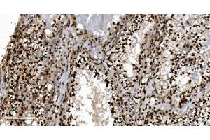 IHC analysis of Ku70 using anti-Ku70 antibody (ABIN7602790).