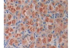 Immunohistochemistry (IHC) image for anti-Ornithine Decarboxylase 1 (ODC1) (AA 15-259) antibody (ABIN7433486)