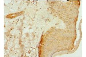 Immunohistochemistry of paraffin-embedded human skin tissue using ABIN7147369 at dilution of 1:100 (ITGB3BP 抗体  (AA 1-177))