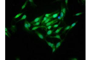 Immunofluorescence staining of Hela cells with ABIN7159800 at 1:125, counter-stained with DAPI. (m1ip1 抗体  (AA 1-183))