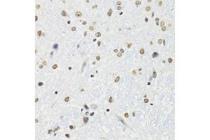 Immunohistochemistry of paraffin-embedded mouse brain using SFPQ antibody (ABIN5970351) at dilution of 1/100 (40x lens). (SFPQ 抗体)