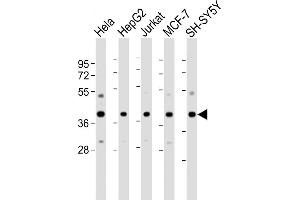 All lanes : Anti-RAE1 Antibody (N-Term) at 1:2000-1:4000 dilution Lane 1: Hela whole cell lysate Lane 2: HepG2 whole cell lysate Lane 3: Jurkat whole cell lysate Lane 4: MCF-7 whole cell lysate Lane 5: SH-SY5Y whole cell lysate Lysates/proteins at 20 μg per lane. (RAE1 抗体  (AA 19-42))