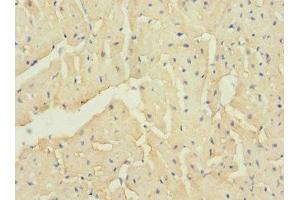 Immunohistochemistry of paraffin-embedded human heart tissue using ABIN7171931 at dilution of 1:100 (TTC32 抗体  (AA 1-151))