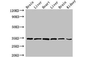 Western Blot Positive WB detected in: Rat brain tissue, Rat liver tissue, Mouse heart tissue, Mouse liver tissue, Mouse brain tissue, Mouse kidney tissue All lanes: MBP antibody at 4 μg/mL Secondary Goat polyclonal to rabbit IgG at 1/50000 dilution Predicted band size: 34, 22, 21, 19, 18 kDa Observed band size: 34 kDa (MBP 抗体  (AA 1-197))