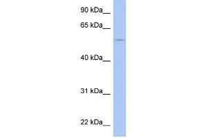 WB Suggested Anti-TRIM58 Antibody Titration: 0. (TRIM58 抗体  (Middle Region))