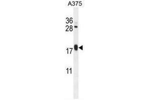 ARL8A Antibody (Center) western blot analysis in A375 cell line lysates (35µg/lane). (ARL8A 抗体  (Middle Region))