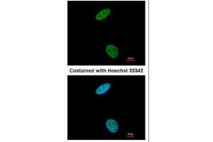ICC/IF Image Immunofluorescence analysis of paraformaldehyde-fixed HeLa, using CDK6, antibody at 1:200 dilution. (CDK6 抗体)