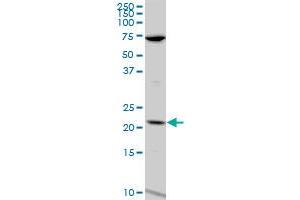 LCN1 polyclonal antibody (A01), Lot # 060814QCS1. (Lipocalin 1 抗体  (AA 24-120))