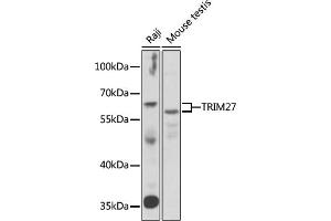 Western blot analysis of extracts of various cell lines, using TRIM27 antibody (ABIN6132592, ABIN6149516, ABIN6149517 and ABIN6222037) at 1:1000 dilution. (TRIM27 抗体  (AA 214-513))