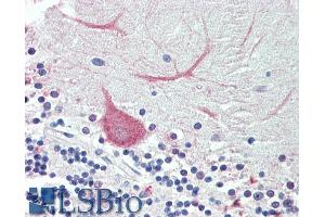 Immunohistochemistry (IHC) image for anti-Tripartite Motif Containing 71, E3 Ubiquitin Protein Ligase (TRIM71) (AA 390-402) antibody (ABIN571137)