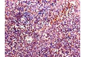 Immunohistochemistry of paraffin-embedded human tonsil tissue using ABIN7156914 at dilution of 1:100 (IL-4 抗体  (AA 25-153))