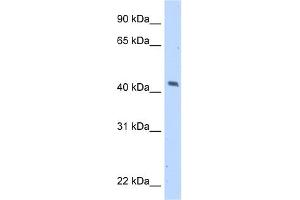 WB Suggested Anti-MAGEA1 Antibody Titration:  5. (MAGEA1 抗体  (C-Term))