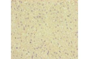 Immunohistochemistry of paraffin-embedded human adrenal gland tissue using ABIN7160738 at dilution of 1:100 (NAA25 抗体  (AA 703-972))