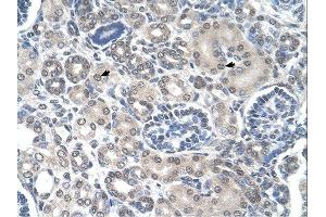 PPAT antibody was used for immunohistochemistry at a concentration of 4-8 ug/ml. (PPAT 抗体  (N-Term))