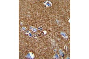 Immunohistochemistry (IHC) image for anti-ATPase, Na+/K+ Transporting, alpha 2 Polypeptide (ATP1A2) antibody (ABIN3002454) (ATP1A2 抗体)