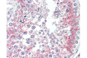 Anti-TCTE3 antibody IHC staining of human testis. (TCTE3 抗体  (N-Term))