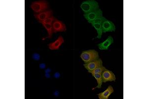 Phospho-ABCA1 (Ser2054) Antibody staining Hela cells(heat shock treatment) by IF/ICC.