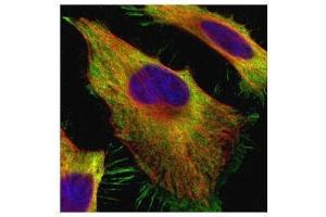 Immunofluorescence (IF) image for anti-Actin, alpha 2, Smooth Muscle, Aorta (ACTA2) (N-Term) antibody (ABIN2857027)