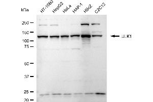 Western blotting analysis using ULK1 antibody (ABIN7800768).