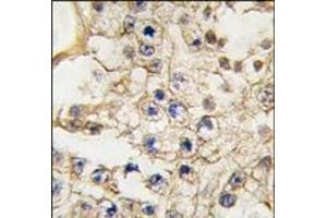 Formalin-fixed and paraffin-embedded human testis tissue reacted with EPHA10 antibody (N-term), which was peroxidase-conjugated to the secondary antibody, followed by DAB staining. (EPH Receptor A10 抗体  (N-Term))