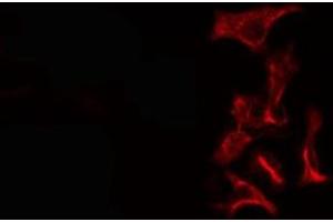 ABIN6276370 staining Hela cells by IF/ICC. (TGFA 抗体  (C-Term))