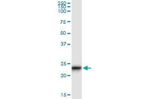 Immunoprecipitation of GUK1 transfected lysate using anti-GUK1 monoclonal antibody and Protein A Magnetic Bead , and immunoblotted with GUK1 MaxPab rabbit polyclonal antibody. (GUK1 抗体  (AA 100-197))