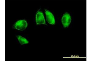 Immunofluorescence of purified MaxPab antibody to POR on HeLa cell. (POR 抗体  (AA 1-680))