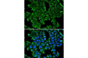 Immunofluorescence analysis of MCF-7 cells using REG3G antibody. (REG3g 抗体)