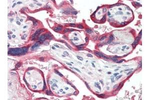 Human Placenta (formalin-fixed, paraffin-embedded) stained with GH1at 10 µg/ml followed by biotinylated goat anti-rabbit IgG secondary antibody, alkaline phosphatase-streptavidin and chromogen. (Growth Hormone 1 抗体)