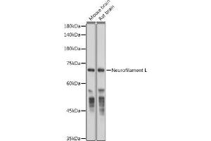 Western blot analysis of extracts of various cell lines, using Neurofilament L antibody (ABIN7268867) at 1:50000 dilution. (NEFL 抗体)