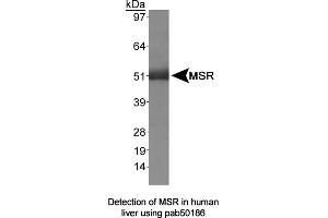 Image no. 1 for anti-Macrophage Scavenger Receptor 1 (MSR1) (AA 300-350) antibody (ABIN363495) (Macrophage Scavenger Receptor 1 抗体  (AA 300-350))
