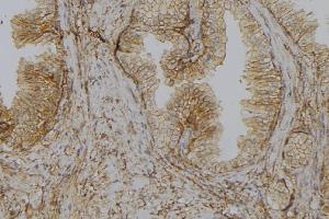 ABIN6278575 at 1/100 staining Mouse colon tissue by IHC-P. (GLYCTK 抗体  (Internal Region))