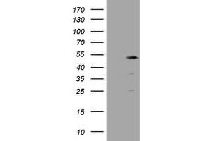 Image no. 4 for anti-TBC1 Domain Family, Member 13 (TBC1D13) antibody (ABIN1501310)