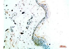 Immunohistochemical analysis of paraffin-embedded human-skin, antibody was diluted at 1:200 (COL14A1 抗体  (AA 1571-1620))