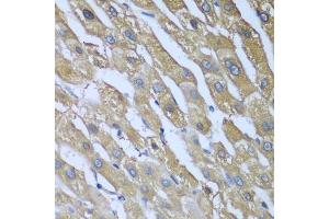 Immunohistochemistry of paraffin-embedded human liver using CAD antibody (ABIN5974557) at dilution of 1/100 (40x lens). (CAD 抗体)