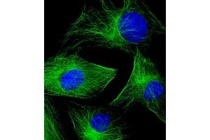 Immunofluorescent analysis of 4 % paraformaldehyde-fixed, 0. (TUBB2A 抗体  (AA 14-46))