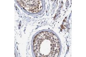 Immunohistochemical staining of human testis with ANKK1 polyclonal antibody  shows cytoplasmic positivity in cells in seminiferus ducts and leydig cells.