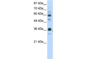 WB Suggested Anti-RPUSD2 Antibody Titration:  5. (RPUSD2 抗体  (N-Term))