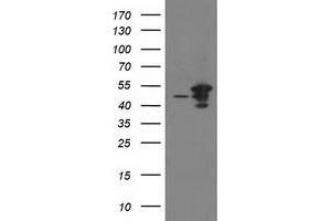 HEK293T cells were transfected with the pCMV6-ENTRY control (Left lane) or pCMV6-ENTRY ARFGAP1 (Right lane) cDNA for 48 hrs and lysed. (ARFGAP1 抗体)