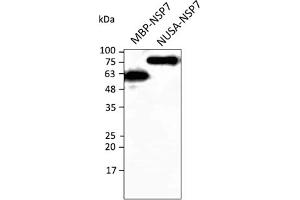 Western Blotting (WB) image for anti-SARS-CoV-2 Non-Structural Protein 7 (NSP7) antibody (ABIN7273019) (SARS-CoV-2 NSP7 抗体)