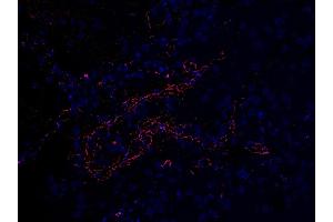 Immunofluoorescent l analysis of paraffin-embedded COVID-19 patient lung tissue using anti- SARS-CoV-2 (COVID-19) Envelope antibody (ABIN1031551, 2 μg/mL). (SARS-CoV-2 Envelope 抗体  (N-Term))