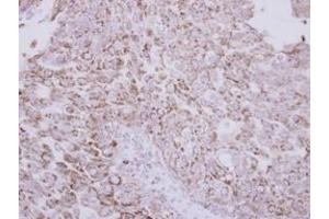 Image no. 1 for anti-Vitamin K-dependent protein C (PROC) (AA 1-236) antibody (ABIN1500426) (PROC 抗体  (AA 1-236))