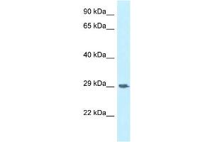 WB Suggested Anti-SIRPG Antibody Titration: 1. (SIRPG 抗体  (Middle Region))