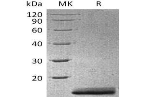 AGR3 Protein (His tag)