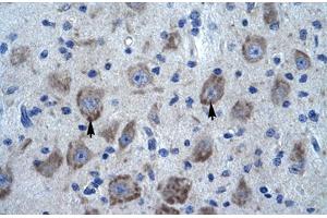 Immunohistochemical staining (Formalin-fixed paraffin-embedded sections) of human brain with KCTD13 polyclonal antibody . (KCTD13 抗体  (AA 26-75))