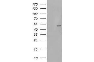 Image no. 1 for anti-phosphorylase Kinase, gamma 2 (Testis) (PHKG2) (AA 1-216) antibody (ABIN1490613)