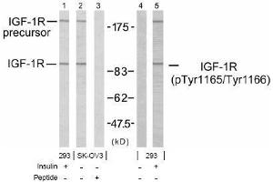 Image no. 1 for anti-Insulin-Like Growth Factor 1 Receptor (IGF1R) (pTyr1165), (pTyr1166) antibody (ABIN197244) (IGF1R 抗体  (pTyr1165, pTyr1166))