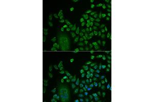 Immunofluorescence (IF) image for anti-LSM4 Homolog, U6 Small Nuclear RNA Associated (LSM4) antibody (ABIN1980258) (LSM4 抗体)